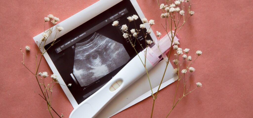 How to Use a Pregnancy Kit