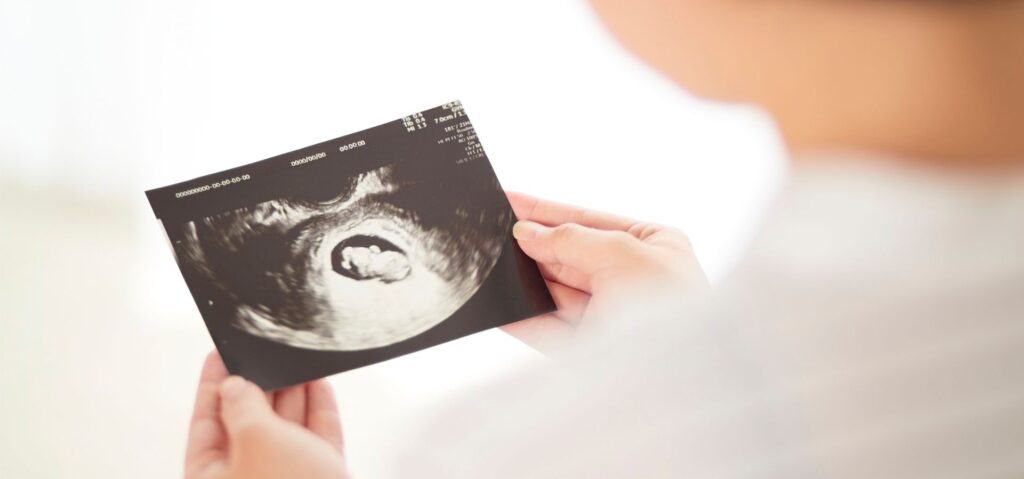 Pregnancy Ultrasound Report